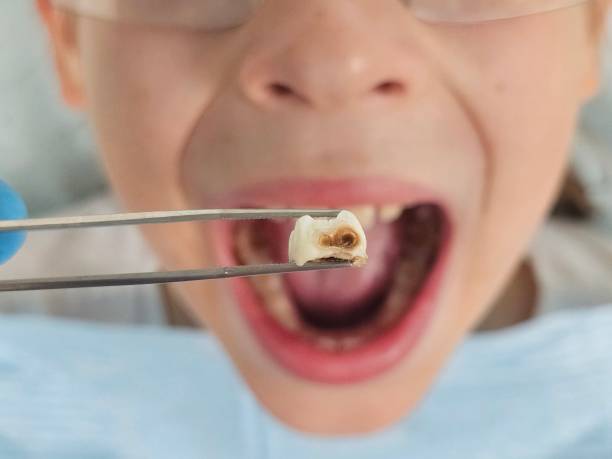 Best Weekend Emergency Dentist in Gate City, VA